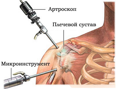Артроскопия в Белоруссии